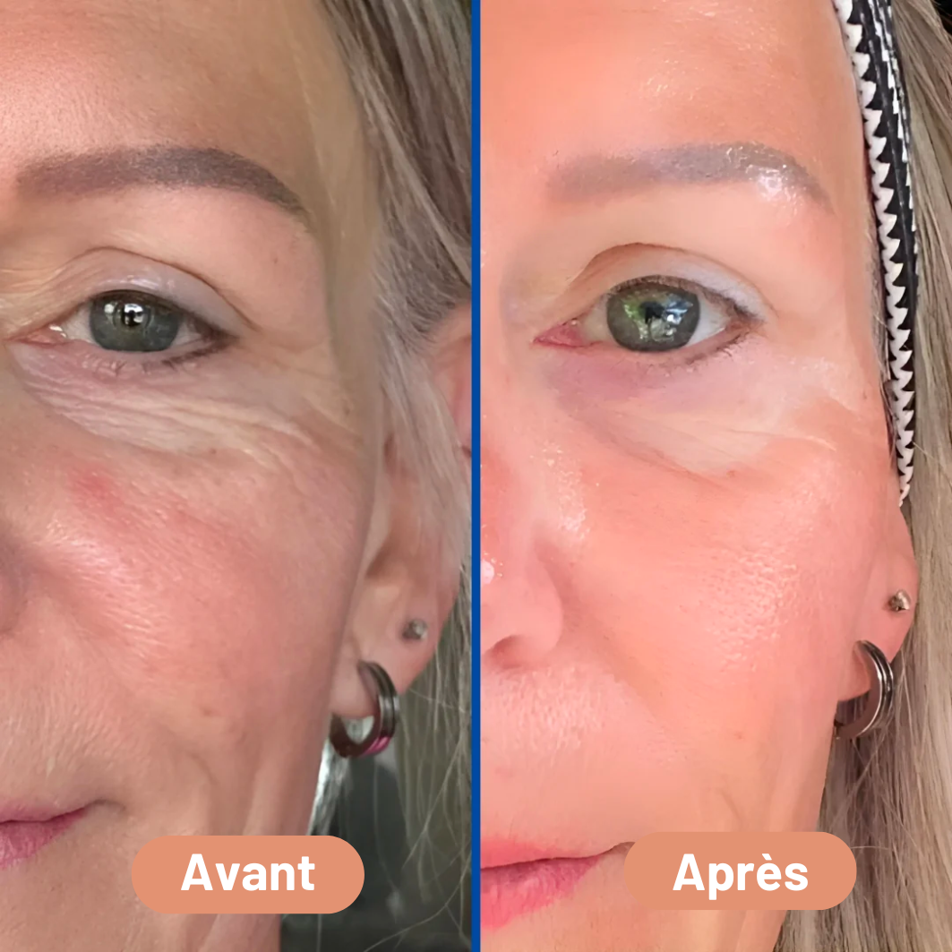 NOVA™ – Pansement en Silicone