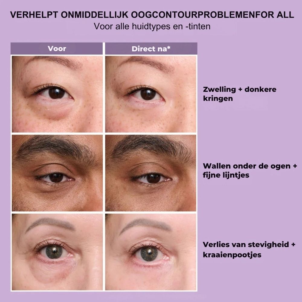 Direct Verstevigende Oogcrème