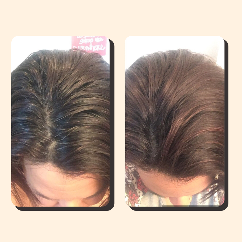Novavita™ –Droogshampoo voor haar 100 ml