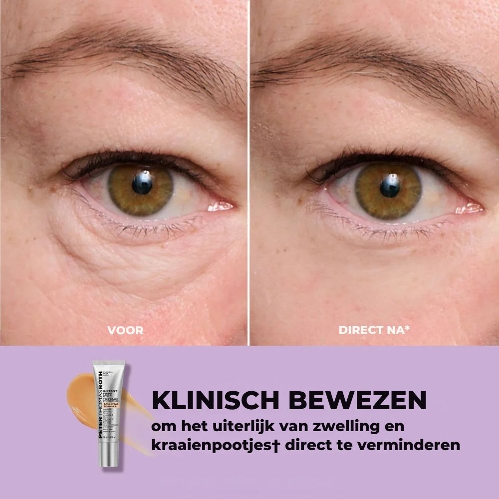 Direct Verstevigende Oogcrème