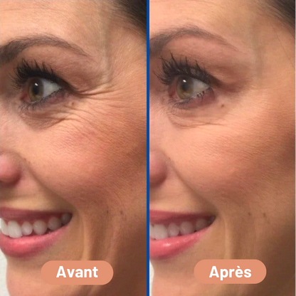 NOVA™ – Pansement en Silicone