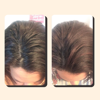 Novavita™ –Droogshampoo voor haar 100 ml