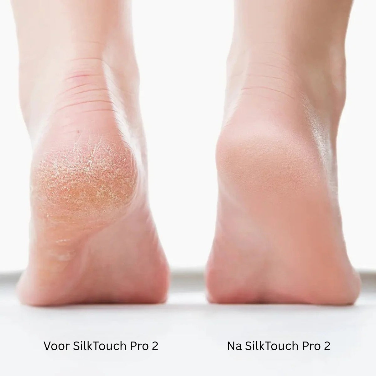 SilkTouch Pro 2