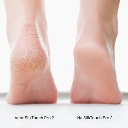 SilkTouch Pro 2
