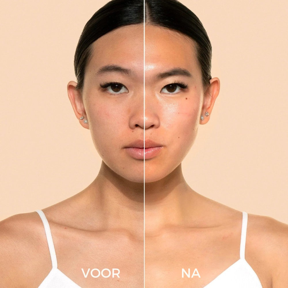 Rice Peel Glow Serum Ampoule