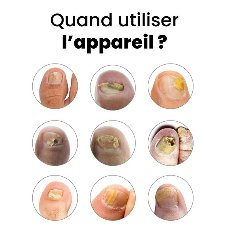 OnyClear™ – Appareil OrthoVital