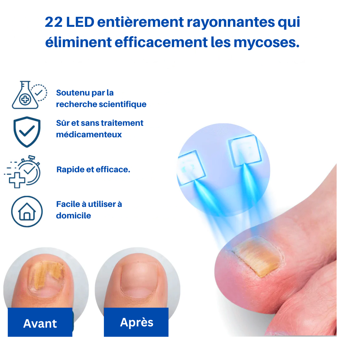 OnyClear™ – Appareil OrthoVital